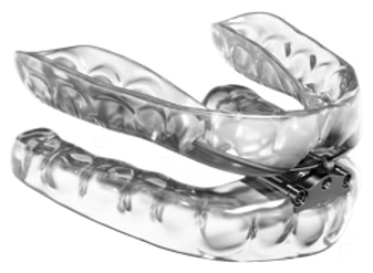 Custom oral appliance for sleep apnea